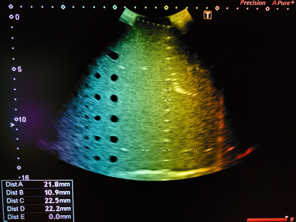 MedIPUT Transforming Ultrasound Imaging with Integrated Photonics